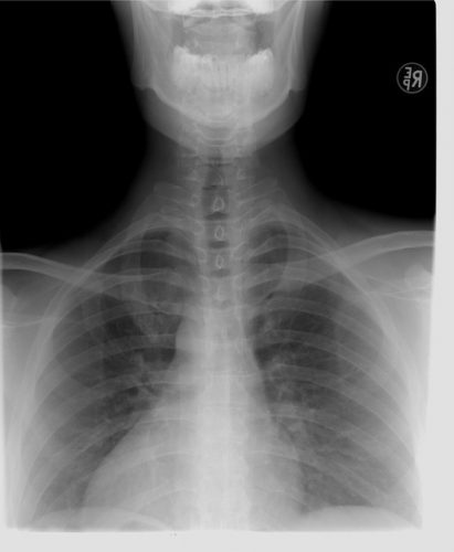 Röntgen nacke och rygg